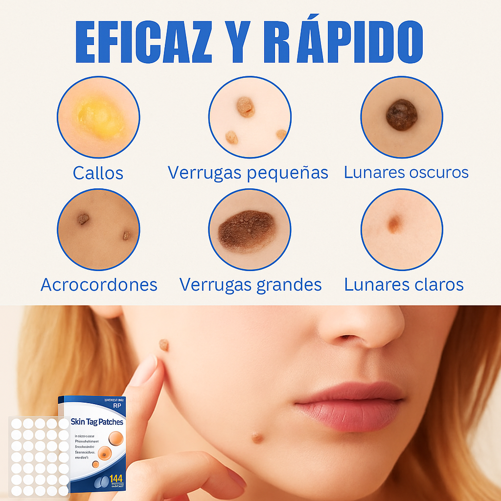 SkinClear - 144 Parches Removedor de Verrugas y Lunares